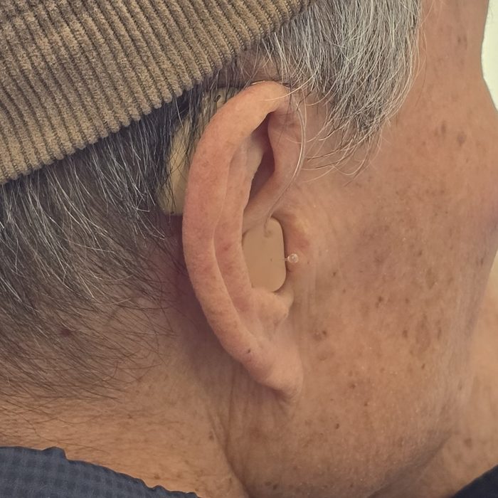 귓속형 보청기를 착용한 고객의 귀