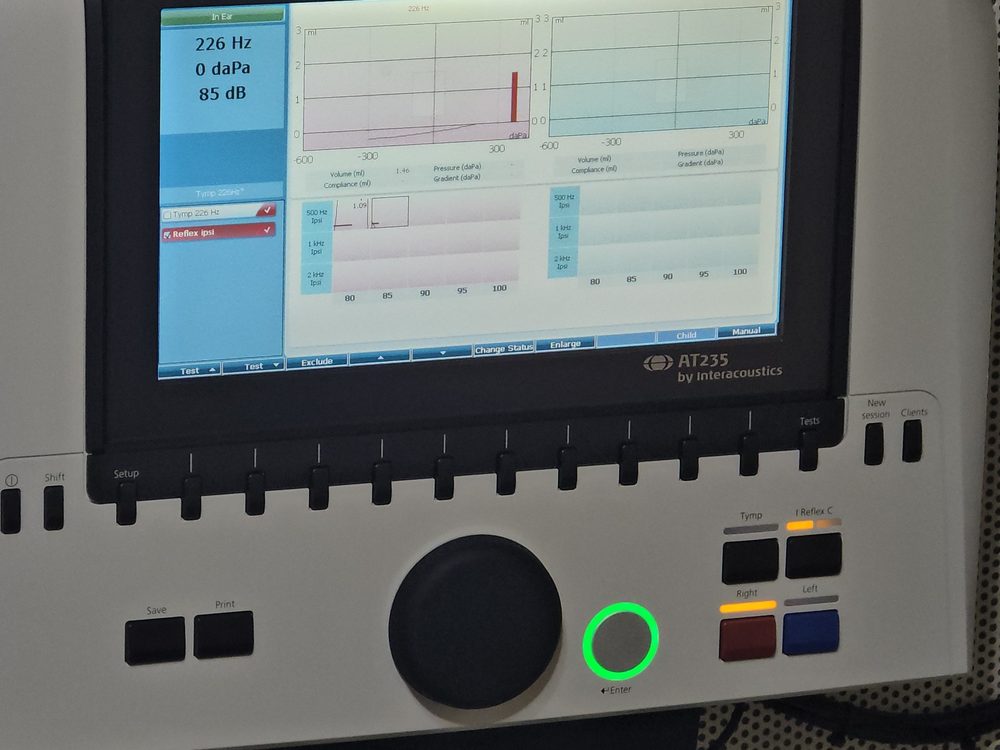 Interacoustics AT235 중이검사기 화면